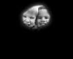 <b>Retinitis pigmentosa</b> - Wikipedia, the free encyclopedia