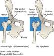 Hip Dysplasia / Markham Veterinary Clinic
