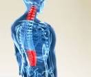 Texas Back Institute : Acute Back Pain, Acute Back &amp; Neck Pain ...