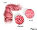 El <b>intestino</b> humano está
