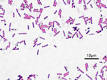 Firmicutes - Wikipedia, the free encyclopedia