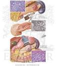 <b>Islet Cell</b> Tumors: <b>Adenomas</b>