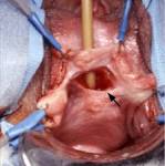 Fistulas of the Genitourinary Tract: A Radiologic Review1