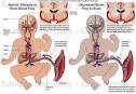 Hypovolemic and Hypoxic Ischemic Encephalopathy (Brain Damage ...
