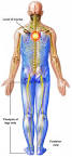 of infantile <b>paralysis</b> is