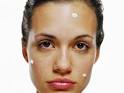 remove acne scars from face