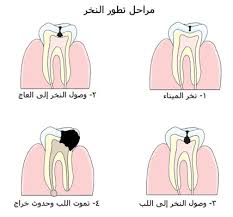 فتاة تختصب بموافقة أمها ؟؟؟ Images?q=tbn:ANd9GcT1Po89252JmYengtLsffjwh2m848eRYggYmPXgPzbxibV2K2du