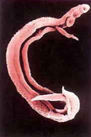 فحص ديدان مهمة من الناحية الطبية Examined medically important worms Images?q=tbn:ANd9GcT1fNVRKEWF6IsRIDTvISQ3Ji2F6B2m6KiaaxWAh-MECB5KNGkh72uA2TUm