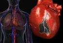 <b>Enfermedades</b> cardiovasculares.