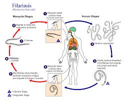 Image result for "Filariasis"