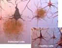 Alzheimer Disease Plaques Seen With Conventional MRI in Animal ...