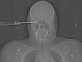 unusual x rays