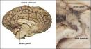 <b>Pineal Gland</b> and Melatonin