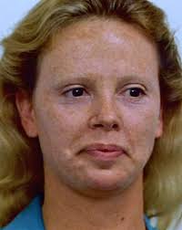 images?q=tbn:ANd9GcT34lTw5TojbDQqRdoROJMOPXpVbb4oPpl38Fg0D3eH_-U_L5HuQ6LI4558Sw