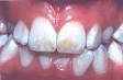 Fluoride Health Effects Database