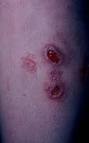 Dermatology Glossary: define your skin
