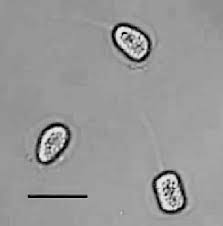 Resultado de imagen para Phyllosticta musarum
