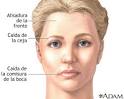 El <b>nervio</b> facial es un <b>nervio</b>