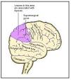 Apraxia Image of Healthline