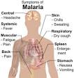 <b>Malaria</b> - Wikipedia, the free