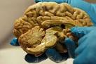 Found! Cells that drive brain's adaptability - Trends News - IBNLive