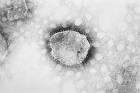 (<b>New world arenaviruses</b>)