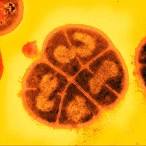 Deinococcus Radiodurans - Latest Research