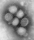 CDC Image of the H1N1 Influenza Virus (Swine Flu) « Off the Charts