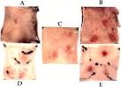 hr <b><b>Arthus Reaction</b></b>Inverted hr <b>Arthus</b> ReactionInverted