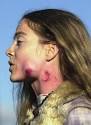 Photo of Oakland PD Inflicted