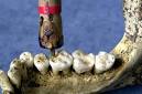 Dig uncovers ancient roots of dentistry - Technology &amp; science ...