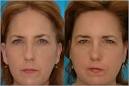  AGING - Well Blog - NYTimes.
