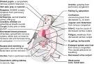 Congestive heart disease - definition of Congestive heart disease ...