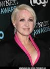 Cyndi Lauper Image Cyndi Laupers Chemical Peel Went Wrong | SurfGossip Picture 7