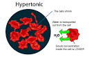 SPM Biology: Types of Solution - Hypertonic