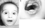 Genetics of congenital hypothyroidism -- Park and Chatterjee 42 (5 ...
