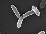 File:<b>Salmonella typhimurium</b>.