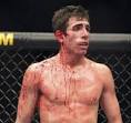 Kenny Florian Expected to Face Nunes at UFC 131 | MMAValor