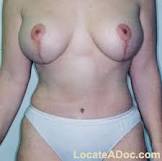 http://t1.gstatic.com/images?q=tbn:ANd9GcTGYfmjdMUOvK_YIaRZ3qch3RlEiWXyZNhm5tdpZ2Qxdst3hjE6GBqAn98L-w