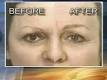Michelle Innocenti is getting a second hair transplant -- not for her head, ... - 1179538741_brows-220x165