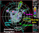 National RADAR WEATHER: What Imperfections Might YOU See?