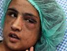 Enlarge Shocking: Sahar Gul,