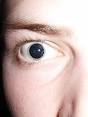 Pupil dilated for examination