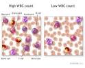 White <b>Blood Cell Count</b>