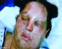 Panic: Patient Kim Grice's