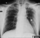 Welcome to LearningRadiology