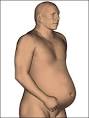 <b>Ascites</b>