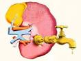 <b>renal</b> é a <b>falência</b> do rim,
