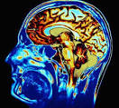 Psychopathy linked to brain damage | TopNews
