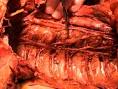 Gross Anatomy Dissections - IME Video Library